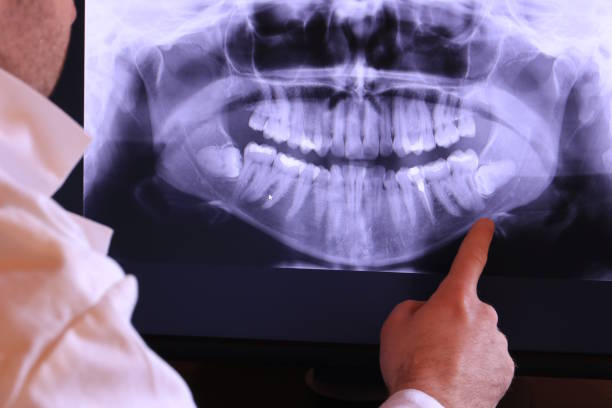 Best Emergency Tooth Extraction  in Ptland, OR